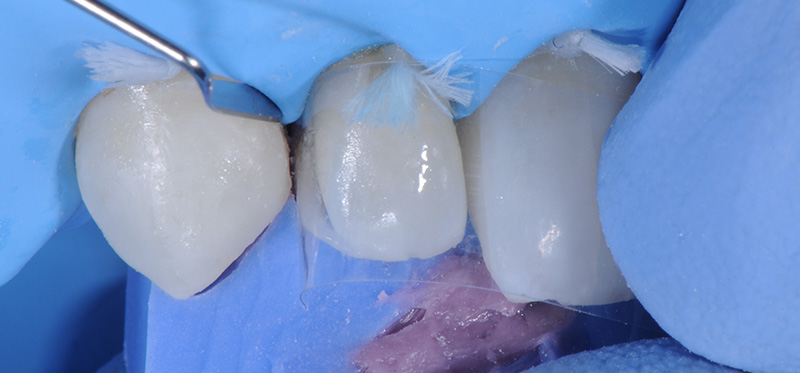 Photo-14-Article-Academie-du-sourire-Cas-C