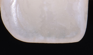 Photo-2-Article-Academie-du-sourire-Cas-A