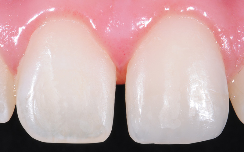 Photo-5-Article-Academie-du-sourire-Cas-A