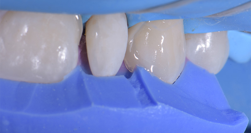 Photo-7-Article-Academie-du-sourire-Cas-B