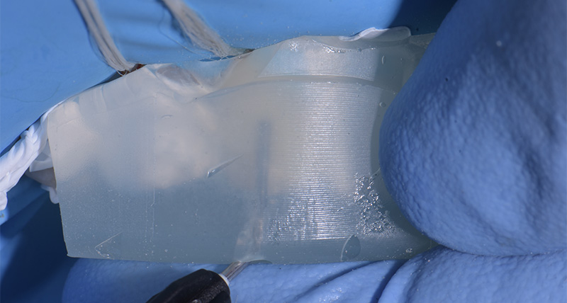 Photo-9-Article-Academie-du-sourire-Cas-B