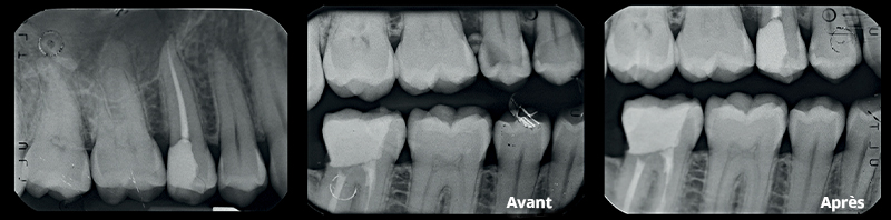 VOCO-composite-fig20