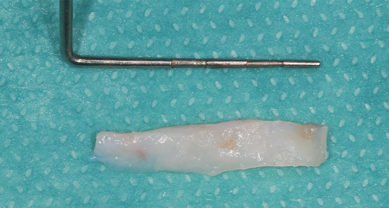 fig-06-recessions-semtob