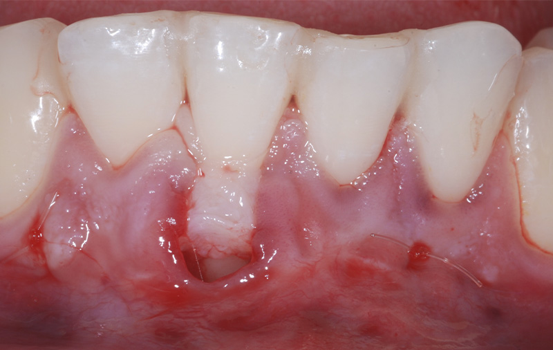 fig-09-recession-semtob