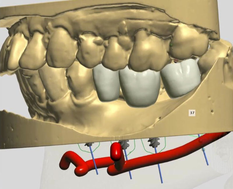 fig-01-amar-chirurgie-guidee