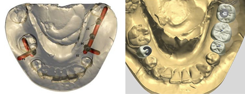 fig-02-amar-chirurgie-guidee