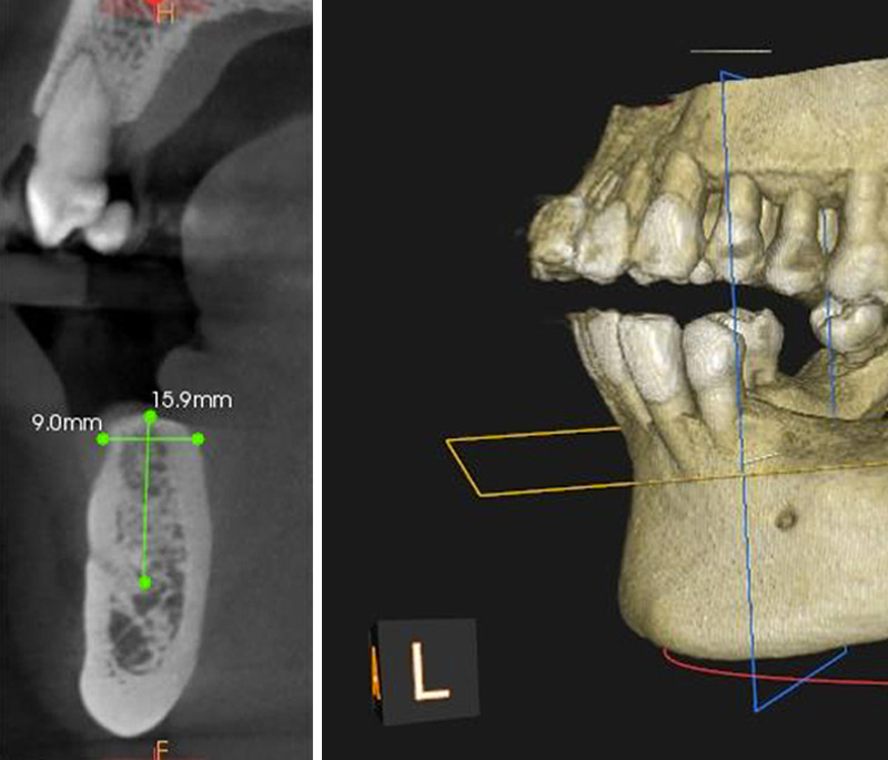 fig-03-amar-chirurgie-guidee