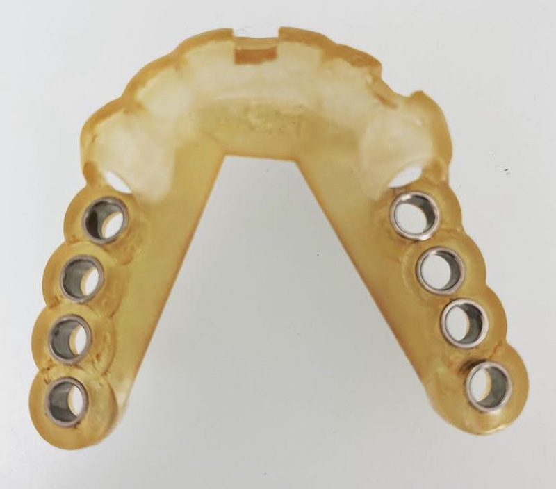 fig-08-amar-chirurgie-guidee