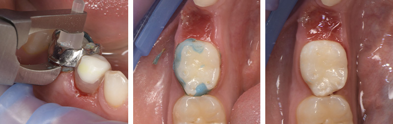 fig-10-laulan-mainteneur-espace
