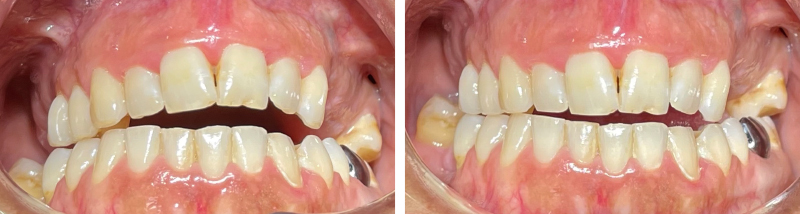 Figure 1 (a) Situation initiale-rehabilitation