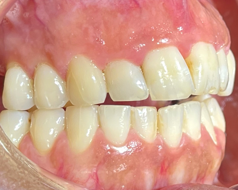Figure 1 (b) Situation initiale-rehabilitation