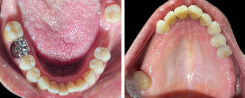 1-3-2Figure 1 (c) Situation initiale-rehabilitation