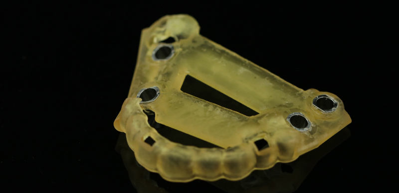 Figure 11 Guide chirurgicale