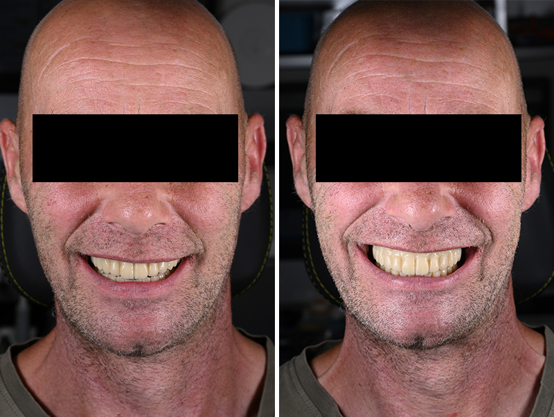 Essayage du prototype imprimé