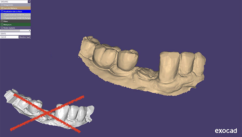Fig-10-Linda-Martin-44-GC-France