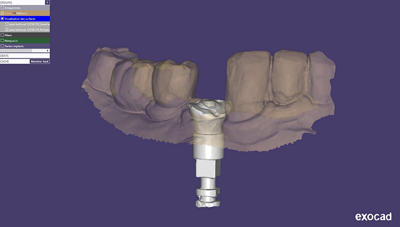Fig-11-Linda-Martin-44-GC-France