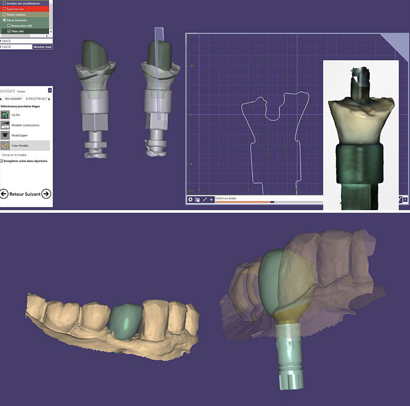Fig-12-Linda-Martin-44-GC-France