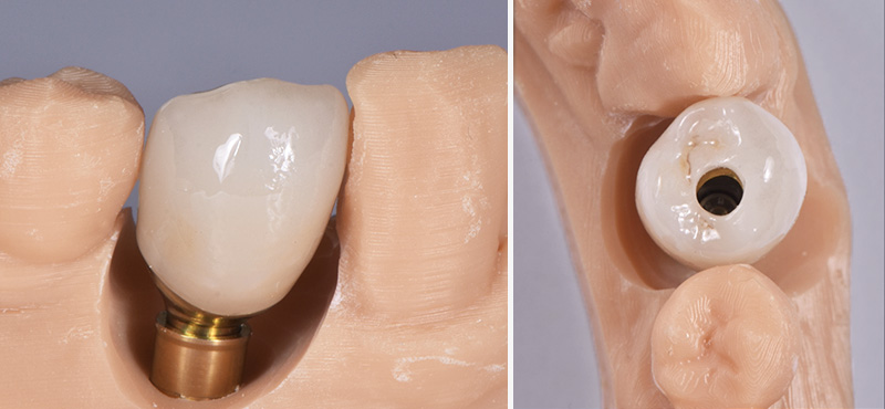 Fig-13-Linda-Martin-44-GC-France