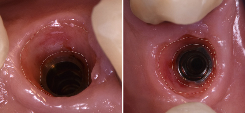 Fig-15-Linda-Martin-44-GC-France