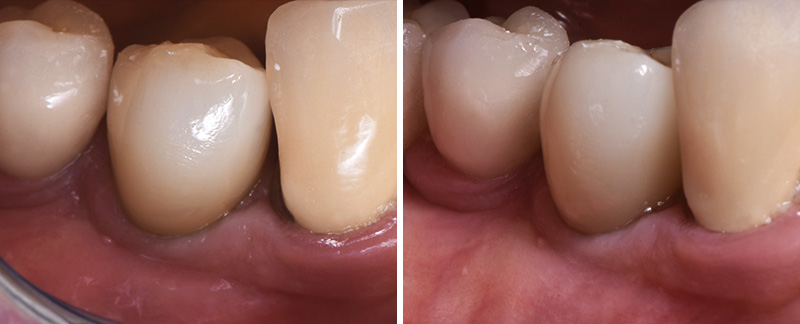 Fig-16-Linda-Martin-44-GC-France