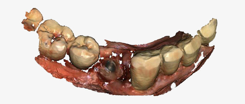 Fig-2-Linda-Martin-44-GC-France