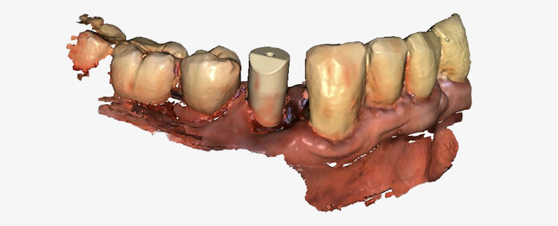 Fig-3-Linda-Martin-44-GC-France