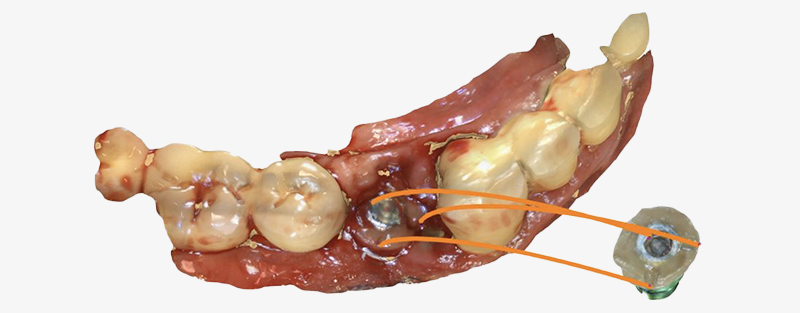 Fig-6-Linda-Martin-44-GC-France