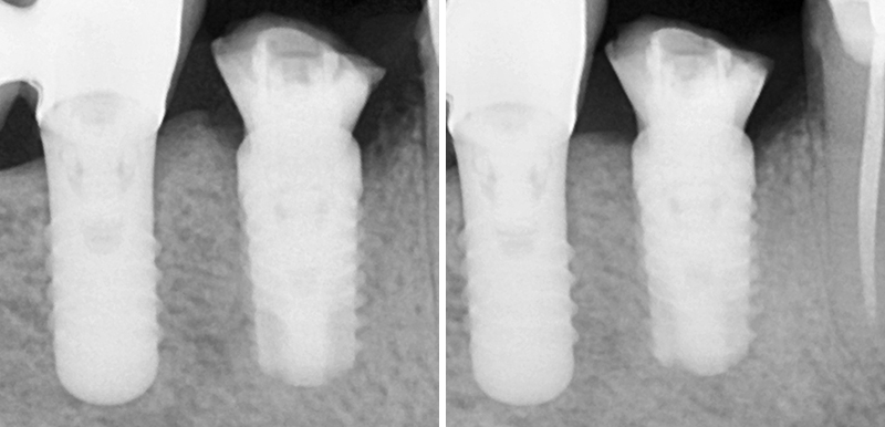 Fig-8a-Linda-Martin-44-GC-France