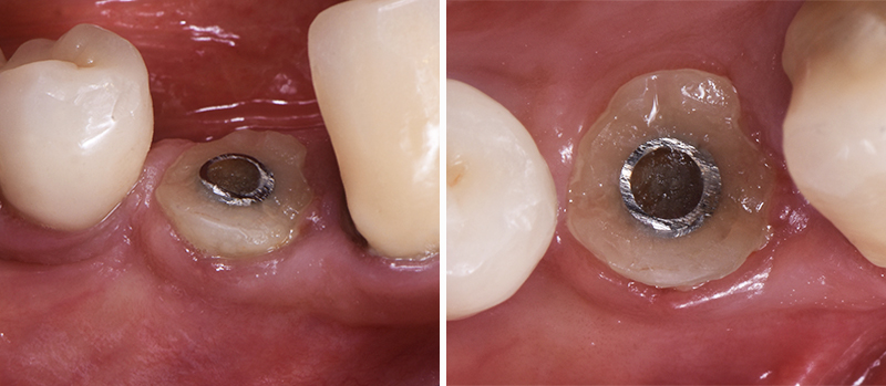 Fig-8b-Linda-Martin-44-GC-France