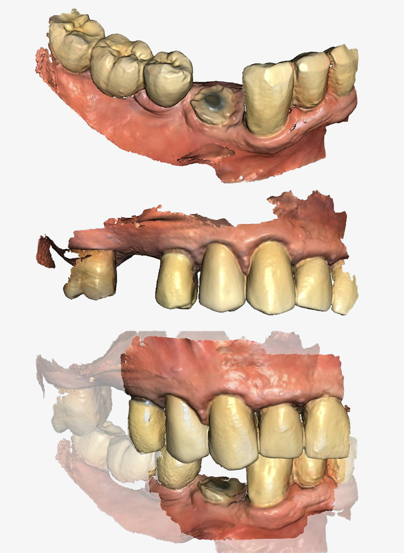Fig-9-Linda-Martin-44-GC-France