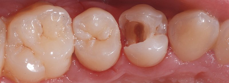 fig-01-voco-situation-initiale