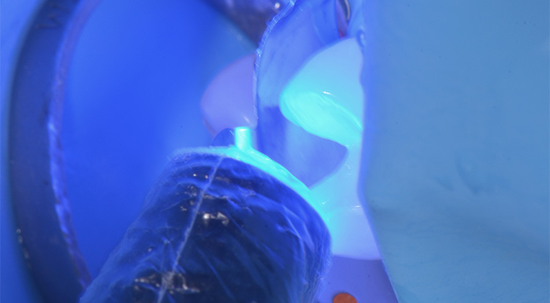 fig-04-voco-restauration