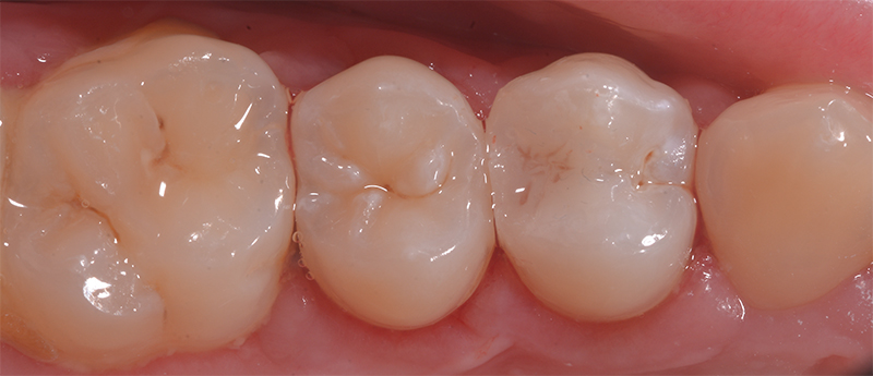 fig-08-voco-situation-finale