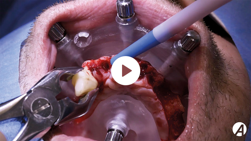 image-article-top5-01