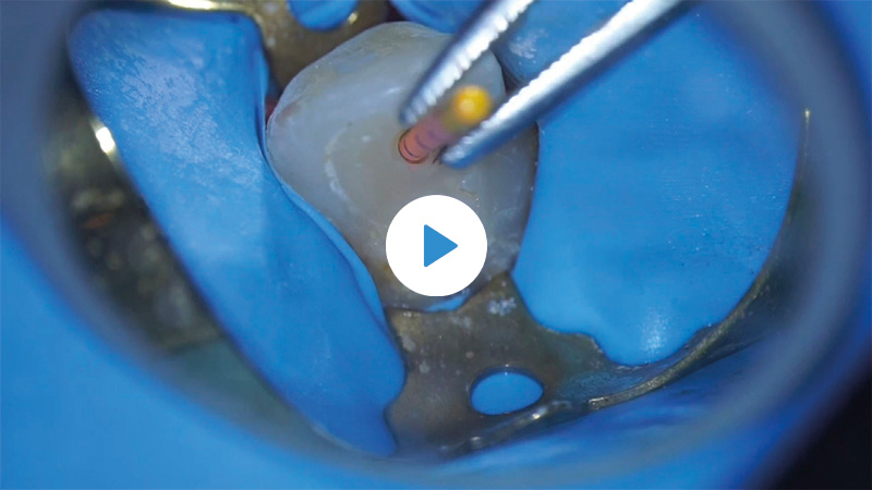 image-article-top5-04