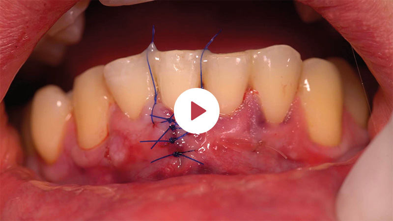 image-article-top5-05