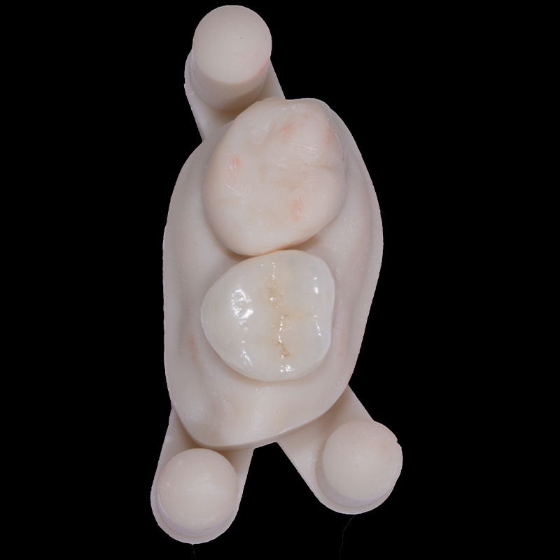 fig-08-dentisterie-adhésive