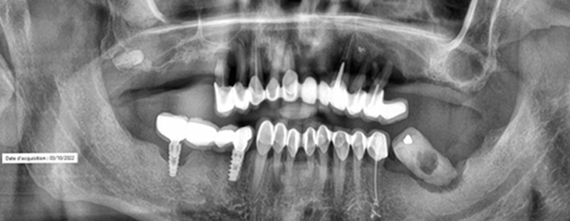 fig-01-guides-étages-luc-sebaoun