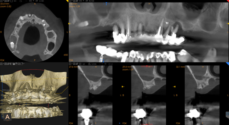 fig-02-guides-étages-luc-sebaoun