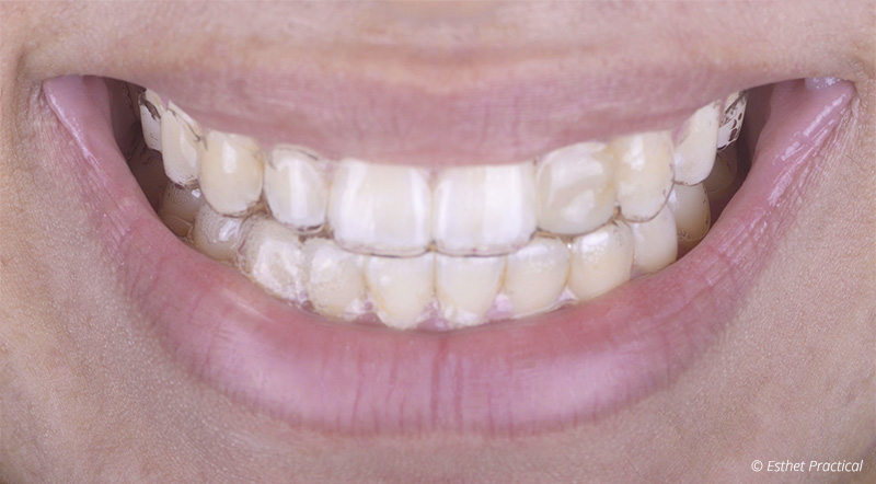 fig-03-bridge-toledano