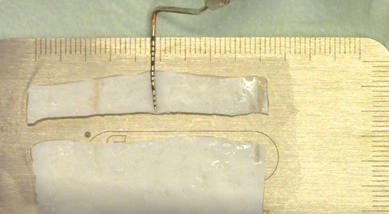fig-04-tunnel-modifié-collets
