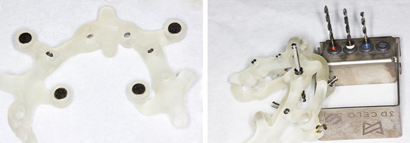 fig-06-07-guides-étages-luc-sebaoun