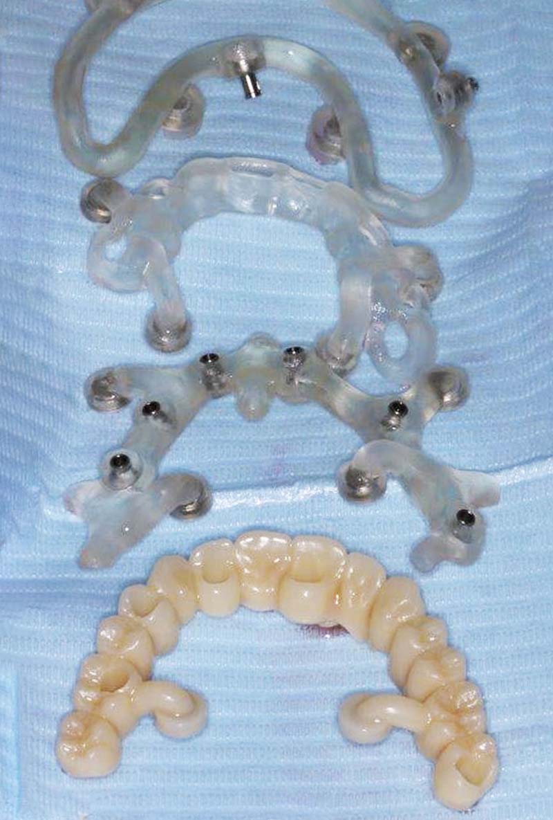 fig-09-guides-étages-luc-sebaoun