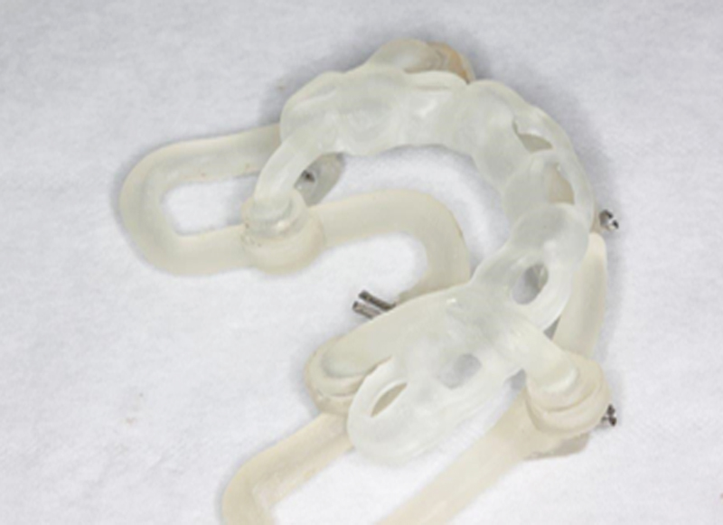 fig-11-guides-étages-luc-sebaoun