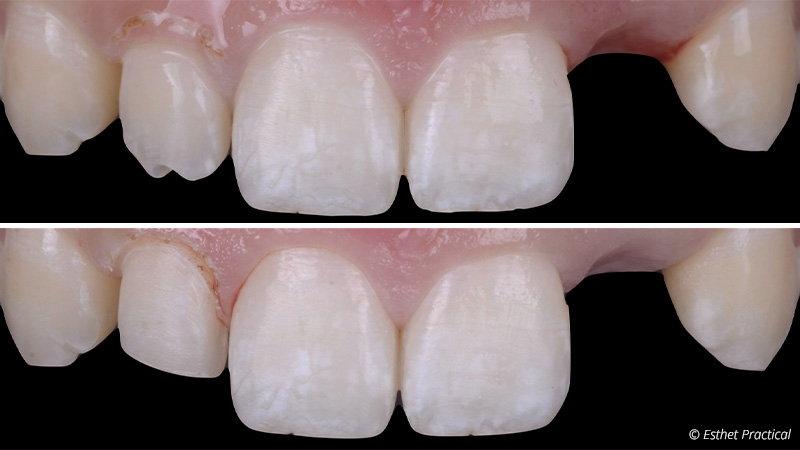 fig-15-bridge-toledano
