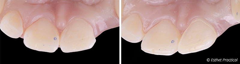 fig-16-17-bridge-cantilever-toledano