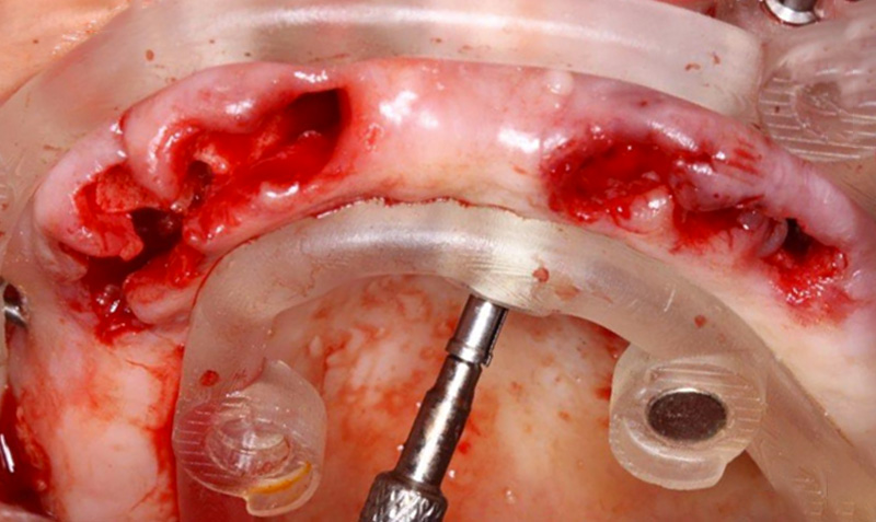 fig-16-guides-étages-luc-sebaoun