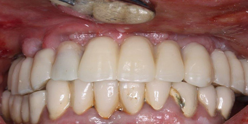 fig-25b-guides-étages-luc-sebaoun