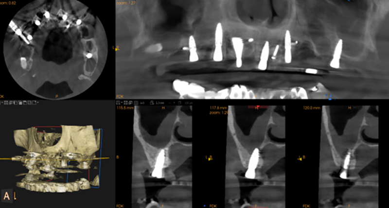 fig-29-guides-étages-luc-sebaoun