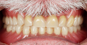 situation initiale-impression 3D